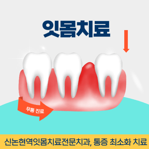 보령치과 보령시 치과 잇몸치료